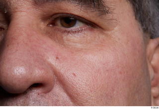 HD Face Skin Santino Freixa cheek eye face nose skin…